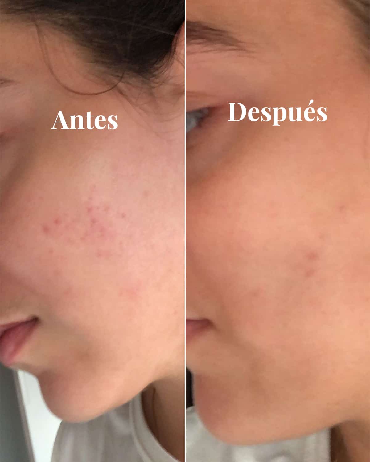 Sérum Iluminador Antimanchas, 30 ml