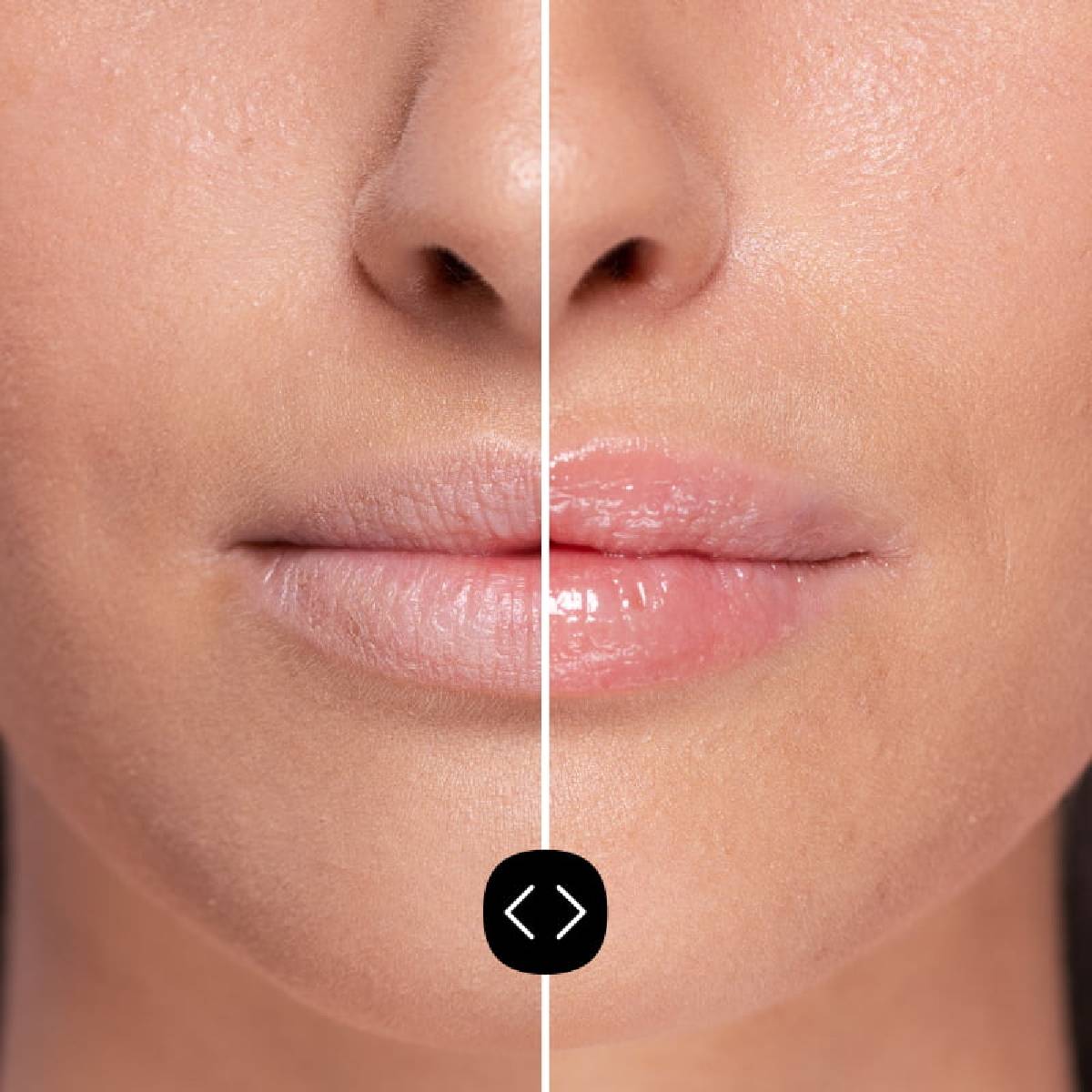 Volumizzante labbra ialuronico Freshly 5 ml