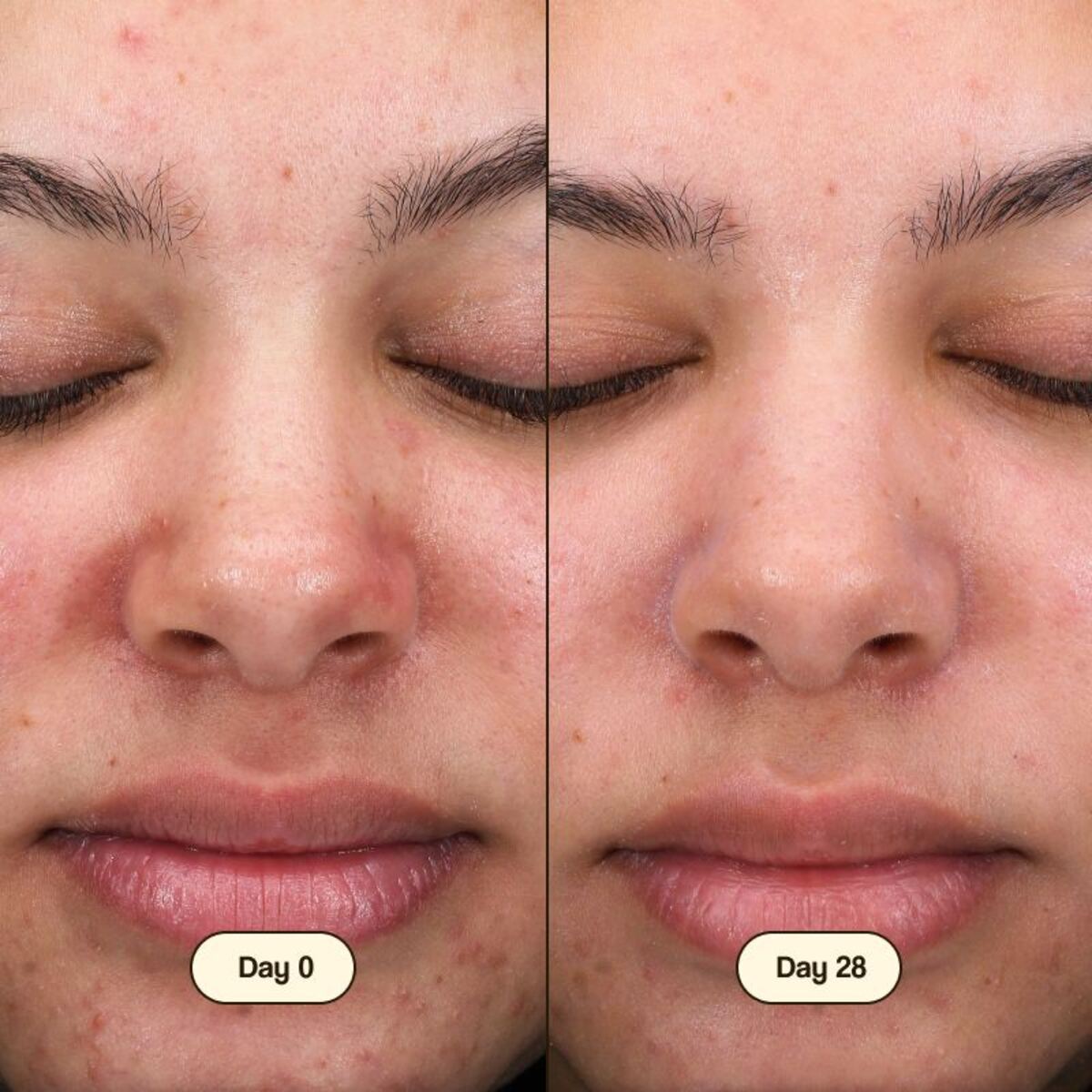 Środek do mycia twarzy Salicylic Fresly 100 ml