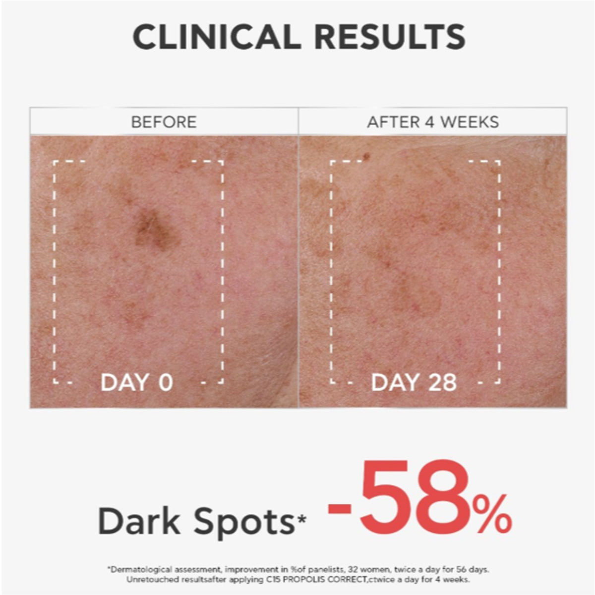 Correctieserum C15 Propolis Antioxidant, antirimpel en verhelderend 30 ml